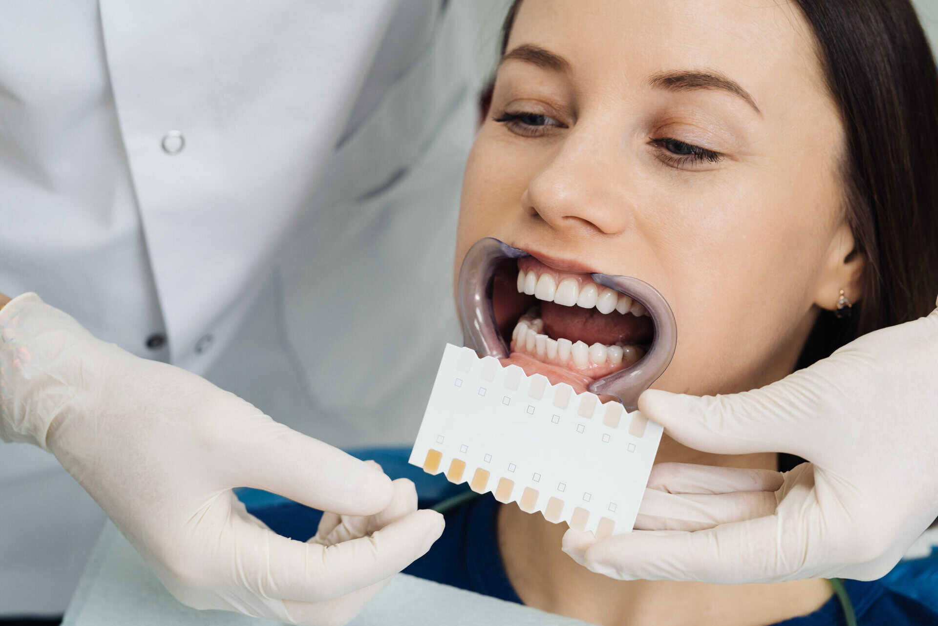 Veneer Composite